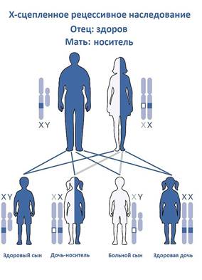 Наиболее частый случай X-сцепленного рецессивного наследования: от матери, которая является носителем, при здоровом отце.